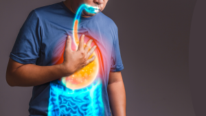 Highlights intestines and stomach with acid reflux indicating GERD